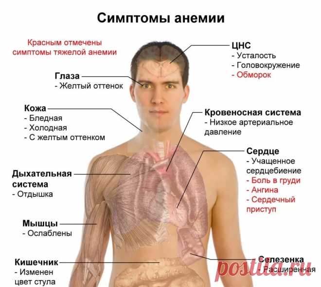 нехватка меланина в организме симптомы и лечение: 2 тыс изображений найдено в Яндекс.Картинках