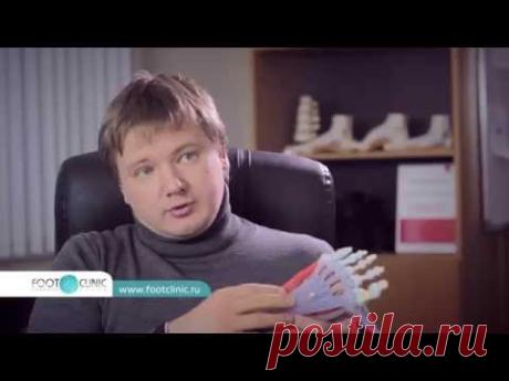 Почему появляется боль в пятке, и всегда ли это пяточная шпора?