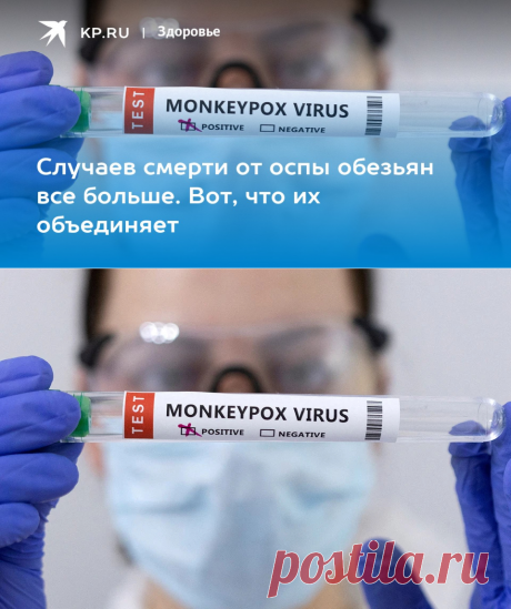 12-8-22-Оспа обезьян: Первые случаи смерти в 2022 году, симптомы, как передается - KP.RU