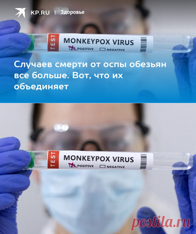 12-8-22-Оспа обезьян: Первые случаи смерти в 2022 году, симптомы, как передается - KP.RU