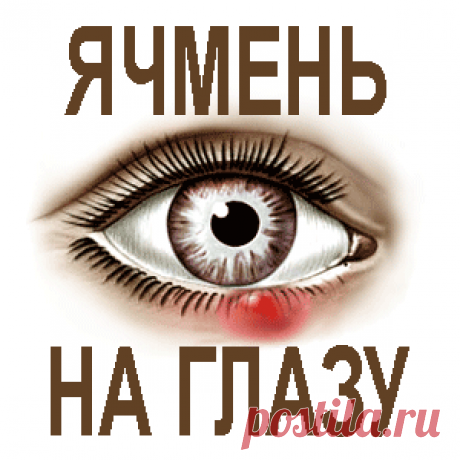 Как вылечить ячмень на глазу народными методами — Всегда в форме!