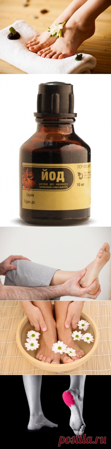 Лечение шпоры на пятке в домашних условиях: принципы терапии и полезные рецепты