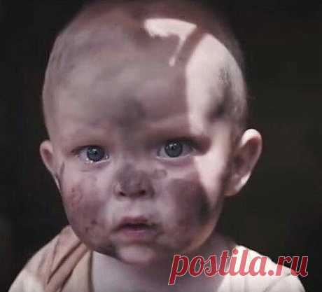 Выживший после артобстрела маленький "сепаратист" бродит по руинам своего дома... Донбасс, лето 2015.