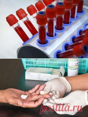 О чем расскажет общий анализ крови