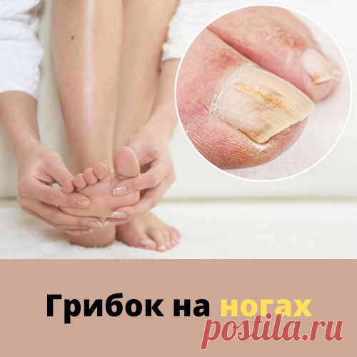 ГРИБОК НА НОГАХ