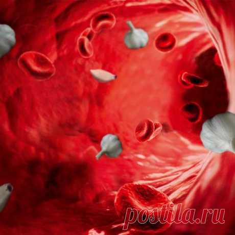 ХИЖИНА ЗДОРОВЬЯ. Очищение сосудов народными средствами