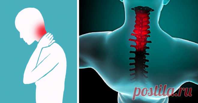 Эта методика избавит тебя от боли в шее и затылке всего за 90 секунд. Очень вовремя!  Действительно работает.