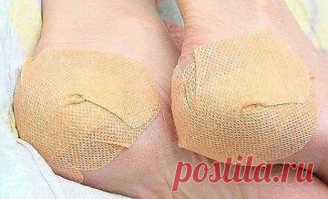 Простой и очень эффективный крем для нежных пяточек
Просто волшебный крем, который избавит от некрасивых трещин на пятках, оздоровит и смягчит кожу ног. Также этот крем замечательно ухаживает за ногтями.
1. Перемешайте 10 мл. витамина А с 1 тюбиком мази календулы (продаются в аптеке) и переложите полученный крем в чистую баночку с крышкой.
2. Смазывайте стопы этим кремом перед сном, сразу после душа. Особое внимание уделите пяточкам и зоне кутикул.
3. Наденьте хлопчатобумажные носки на ночь.
Ес