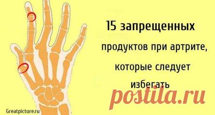 15 запрещенных продуктов при артрите, которые следует избегать