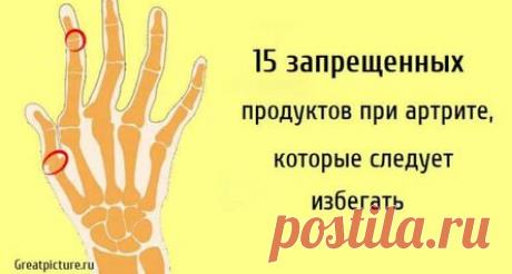 15 запрещенных продуктов при артрите, которые следует избегать