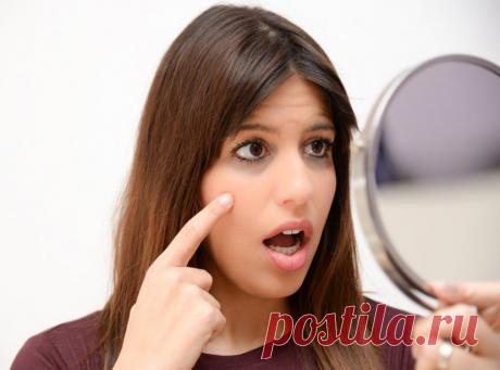 Мешки под глазами - причины появления и способы устранения &amp;raquo; Женский Мир