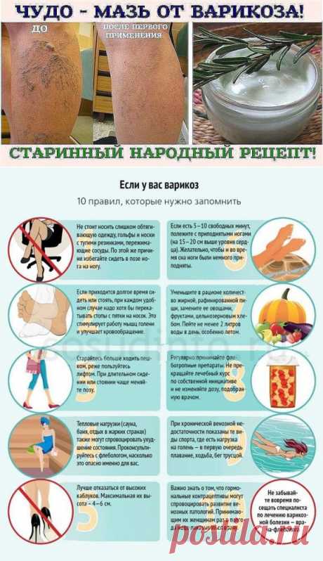 чудо-мазь от варикоза - Самое интересное в блогах