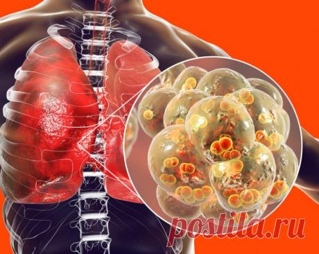 Как выявить пневмонию на ранней стадии / Будьте здоровы