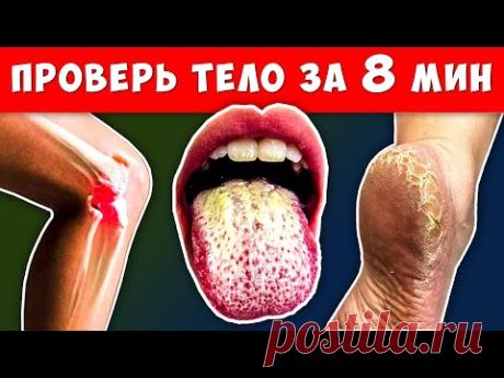 Ваше тело Просит вас о Помощи! 22 тревожных Сигнала и что с этим Делать...