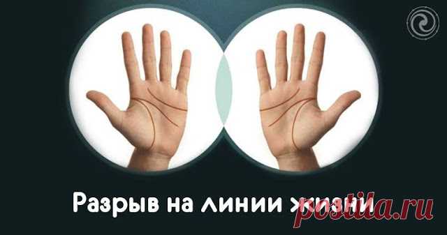 Разрыв на линии жизни 
 
Линии на руке человека, в отличии от рисунков на подушечках пальцев, могут меняться в течении жизни. Неопытные хироманты очень любят короткие и оборванные линии Жизни - и сразу готовы вынести приго…