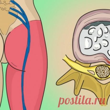 Одно простое упражнение чтобы избавиться от боли в пояснице и защемления седалищного нерва.