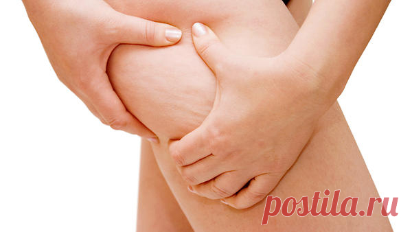 10 главных причин возникновения целлюлита Перечень факторов, непосредственно вызывающих появление апельсиновой корки у представительниц прекрасного пола.  Fotodom.ru«Факторы, непосредственно вызывающие целлюлит, действуют только в случае, есл…