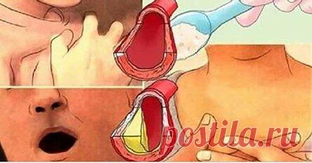Мой кардиолог прочистил мои артерии и снял высокое кровяное давление, используя всего 4 столовые ложки этого средства!