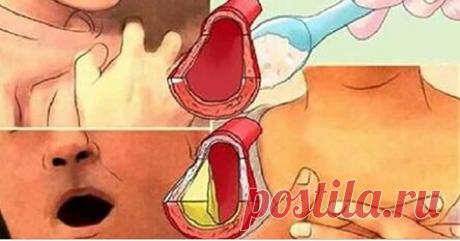 Мой кардиолог прочистил мои артерии и снял высокое кровяное давление, используя всего 4 столовые ложки этого средства!