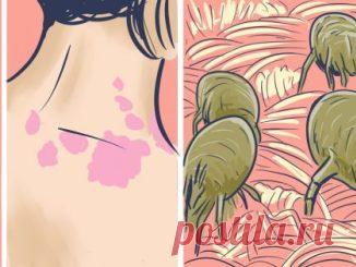 Рецепт с медом для лечения щитовидной железы — Копилочка полезных советов