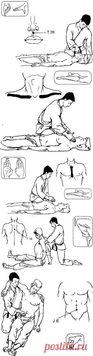 Техника Каппо / КАППО.Японская техника реанимации в практике боевых искусств