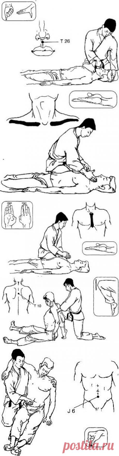 Техника Каппо / КАППО.Японская техника реанимации в практике боевых искусств