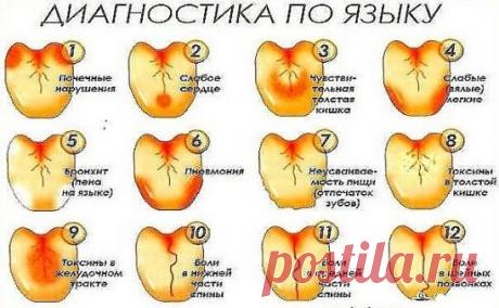 (1) Одноклассники