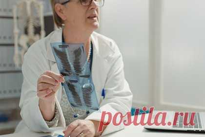 Найден скрытый «пусковой механизм» рака легких