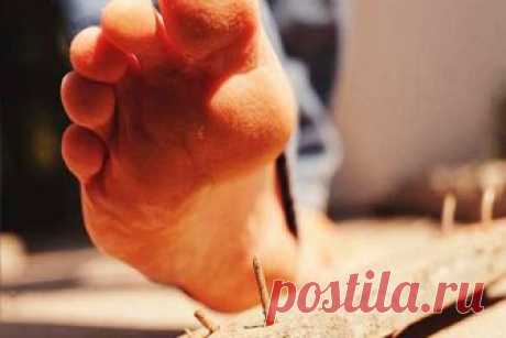 ПРОКОЛОЛ НОГУ ржавым гвоздем: что делать в домашних условиях, чем лечить? ЧТО ДЕЛАТЬ, если ребенок наступил на гвоздь? | Семья и мама