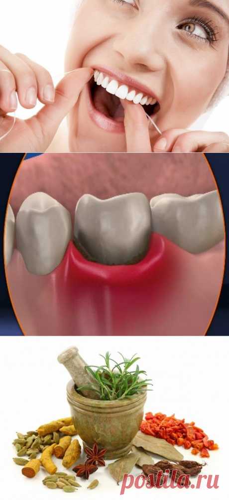 Лечим пародонтоз в домашних условиях / Будьте здоровы
