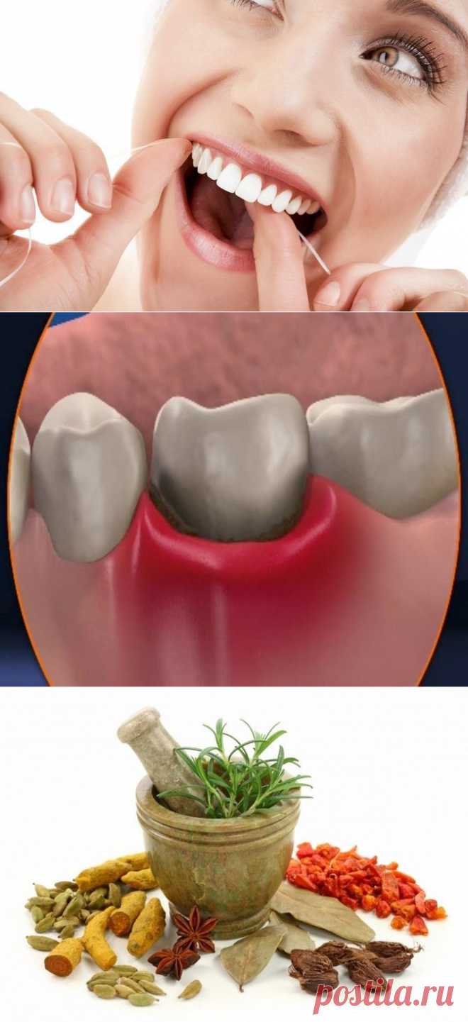 Лечим пародонтоз в домашних условиях / Будьте здоровы