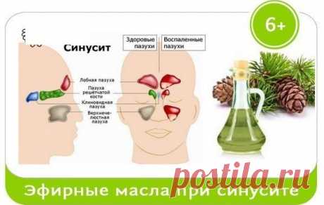 Эфирные масла избавят от синусита — Умный совет