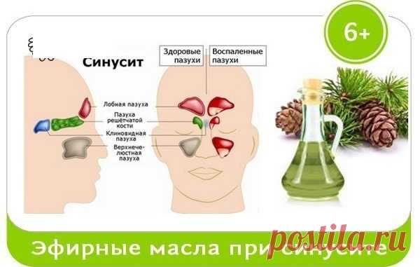 Эфирные масла избавят от синусита — Умный совет