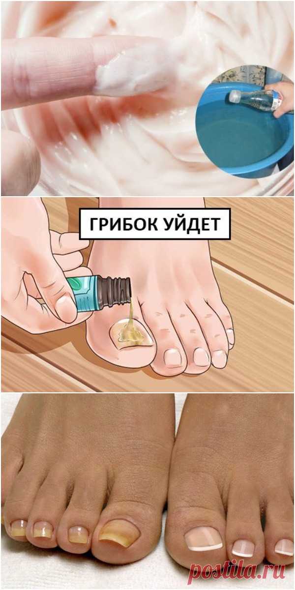 От этой смеси исчезает грибок на ногах и руках. Мгновенный результат! | Всё для Тебя