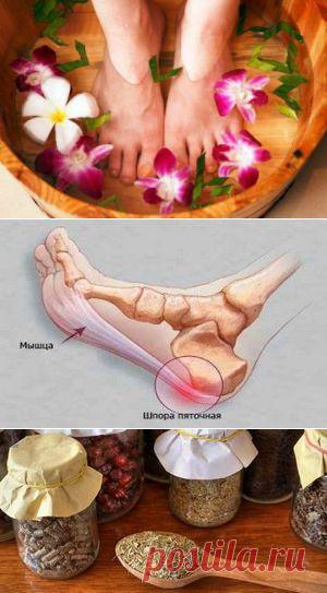 Рецепты народной медицины для лечения пяточной шпоры / Будьте здоровы