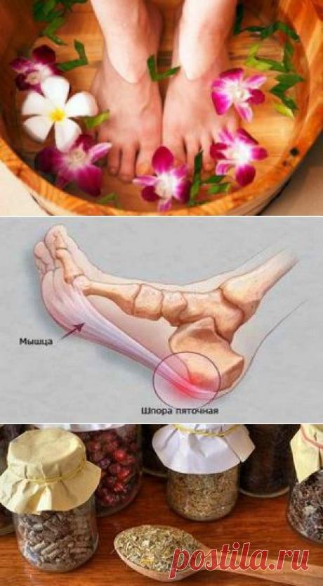 Рецепты народной медицины для лечения пяточной шпоры / Будьте здоровы