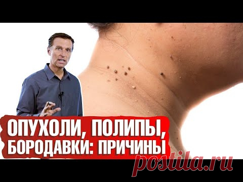 Причины возникновения опухолей ► Почему появляются бородавки, полипы и опухоли?