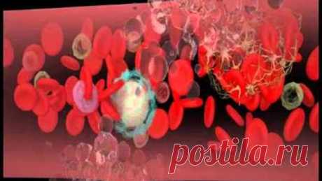 1.  Не хочешь умереть от тромбов - просто пей этот напиток.
2.  Лечение кашля народными средствами.
3.  Чесночное масло снимет спазмы сосудов головного мозга.
4.  СИРОП СОЛОДКИ - ЧИСТКА ЛИМФОСИСТЕМЫ.
5.  РЕЦЕПТ  ОТ  ВЫСОКОГО  ДАВЛЕНИЯ.
6.  ГРЕЧКА! СТРАШНЫЙ ВРАГ ЖИРА!
7.  КАК ИЗБАВИТЬСЯ ОТ ГРИБКА БЕЗ ДОРОГИХ ЛЕКАРСТВ.
8.  Лечимся картофелем.
9.  Интересные старые рецепты для женского здоровья.
10.  6 ЛЕЧЕБНЫХ НАПИТКОВ ДЛЯ ЖЕНЩИН.