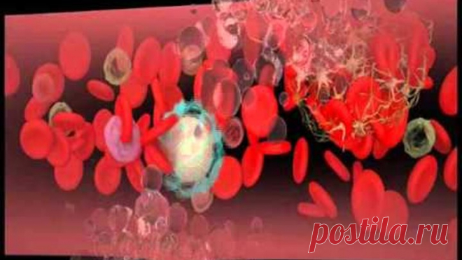 1.  Не хочешь умереть от тромбов - просто пей этот напиток.
2.  Лечение кашля народными средствами.
3.  Чесночное масло снимет спазмы сосудов головного мозга.
4.  СИРОП СОЛОДКИ - ЧИСТКА ЛИМФОСИСТЕМЫ.
5.  РЕЦЕПТ  ОТ  ВЫСОКОГО  ДАВЛЕНИЯ.
6.  ГРЕЧКА! СТРАШНЫЙ ВРАГ ЖИРА!
7.  КАК ИЗБАВИТЬСЯ ОТ ГРИБКА БЕЗ ДОРОГИХ ЛЕКАРСТВ.
8.  Лечимся картофелем.
9.  Интересные старые рецепты для женского здоровья.
10.  6 ЛЕЧЕБНЫХ НАПИТКОВ ДЛЯ ЖЕНЩИН.