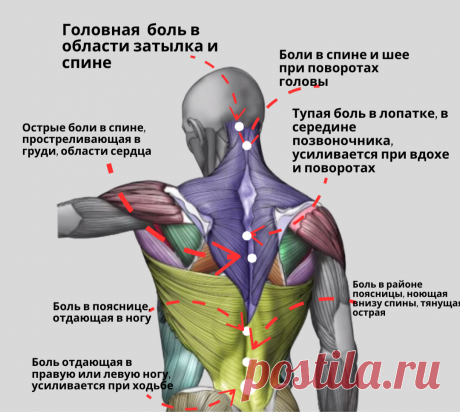 Виды боли в спине и их причины: не потеряйте эту шпаргалку | REHAB.YOU | Дзен