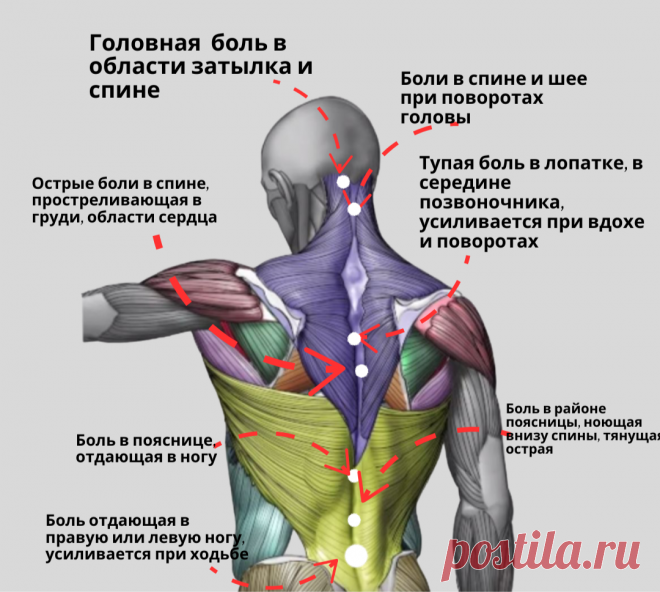 Виды боли в спине и их причины: не потеряйте эту шпаргалку | REHAB.YOU ...