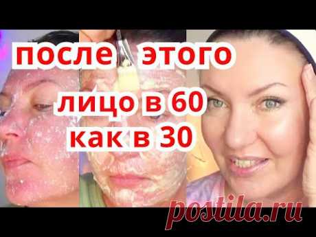 Всего 1 Раз В НЕДЕЛЮ и Лицо Моложе на 10 Лет ! Маска для лица от Морщин