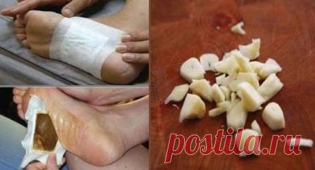 Фантастическая детоксикация. Всего за три дня организм очистится от токсинов | Лучше быть красивым и здоровым! | Яндекс Дзен