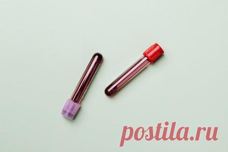 Гематолог перечислил причины появления «жирной» крови. Врач-гематолог Павел Трахтман рассказал о причинах появления «жирной» крови. «Подобные диагнозы обычно получают полные люди с нарушенным холестериновым обменом», — добавил он. Избыточный жир в организме не успевает перерабатываться ферментными системами и циркулирует в крови.