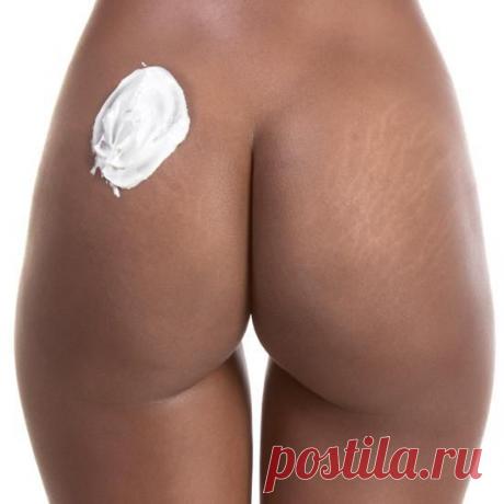 Борьба с растяжками: Эффективные салонные процедуры и домашний уход | Парфюмерия, косметика и причёски | Женский журнал Lady.ru