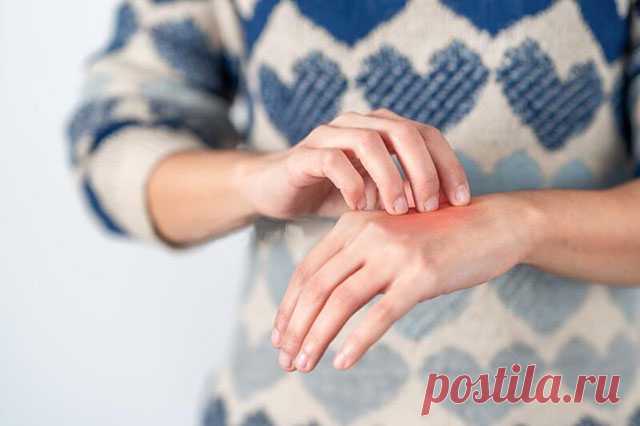 Народная медицина и атопический дерматит — ДОМАШНИЕ