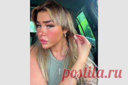 Модель Playboy лишилась части волос после самостоятельного окрашивания. Модель Playboy Саммер Карен лишилась части волос после самостоятельного окрашивания в домашних условиях. Девушка решила к лету сменить цвет прядей и стать блондинкой. Однако косметическая процедура имела негативные последствия для внешности юзерши, оставшейся с отвалившимися прядями.