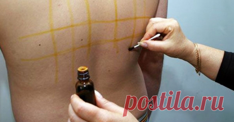 Йодная Сетка: Целебные Свойства Простых Линий