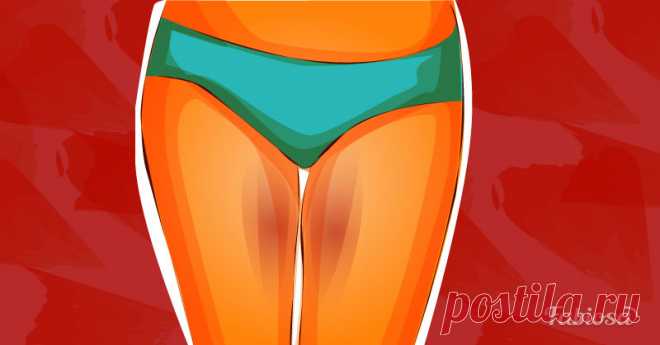 Как осветлить потемневшую кожу на внутренней стороне бедер.Fabiosa