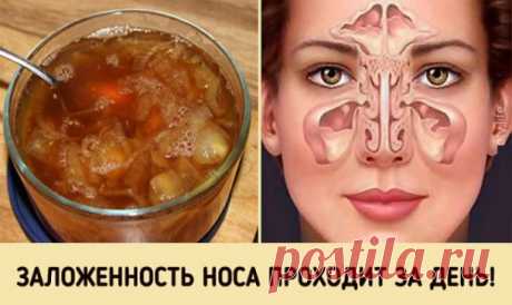 Супер-средство от заложенного носа. Будете свободно дышать уже на утро! — Копилочка полезных советов